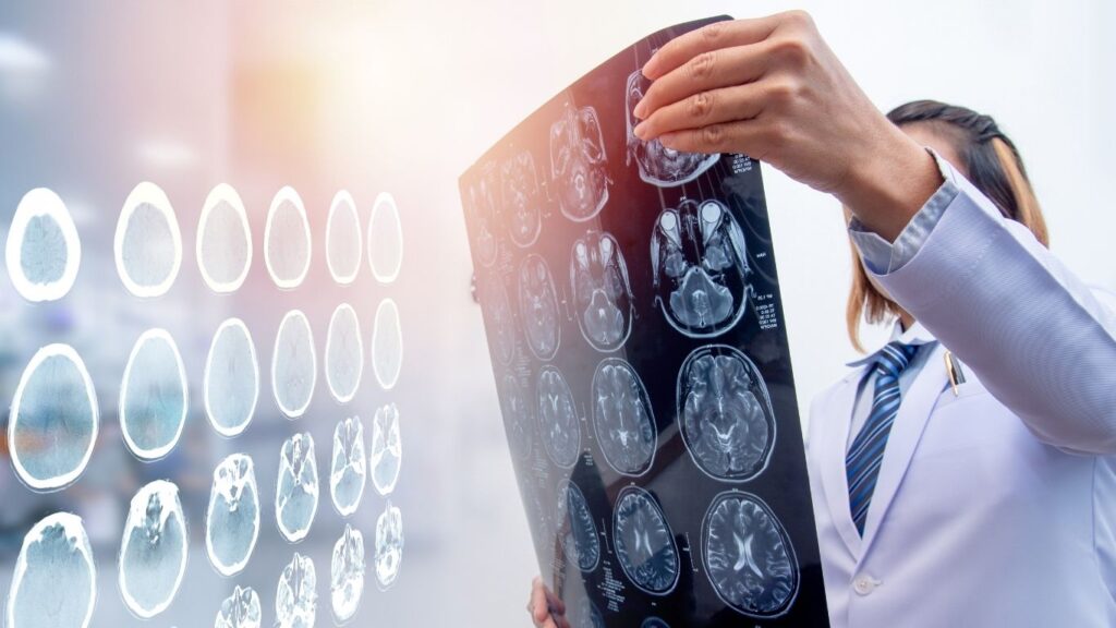 Effects of Traumatic Brain Injury