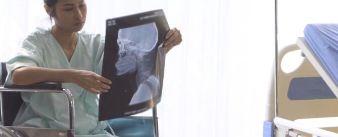 Navigating the Challenges of Post-Concussion