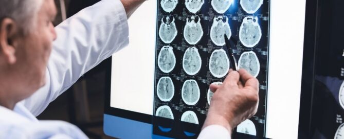 Medical expert examining neurological brain scans for delayed concussion or trauma symptoms.